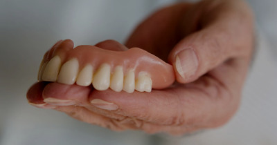 protesi dentale mobile o dentiera